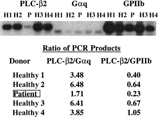 Fig. 4. PLC-β2, GPIIb, and Gαq mRNA levels in the patient and healthy subjects. / cDNA from the patient (P) and healthy subjects (H) was amplified under conditions of linearity of amplification by PCR using specific primers for PLC-β2 corresponding to 3188 nt to 3212 nt (forward) and 4492 nt to 4516 nt (reverse), Gαq (full coding sequence, 1080 nt), and a 1230-bp fragment of GPIIb. The products were transferred to membrane and analyzed by phosphorimaging. The ratios of the PCR products in PLC-β2 to those in Gαq and GPIIb are shown. The findings indicate a decrease in PLC-β2 mRNA in the patient relative to Gαq and GPIIb mRNA.