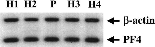Fig. 5. Platelet PF4 mRNA levels in patient and healthy subjects. / Platelet RNA from the patient (P) and healthy subjects (H) was subject to RT-PCR in the presence of 32P-dCTPs using primers for PF4 corresponding to 48-68 nt (forward) and 313-337 nt (reverse), and for β-actin, as described in “Patient, materials, and methods.” The products were subjected to gel electrophoresis, transferred to membrane, and analyzed. Results shown are representative of 2 separate experiments.