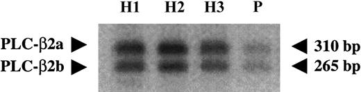 Fig. 6. Relative amounts of alternatively spliced products of PLC-β2. / Normalized first-strand cDNA from the patient (P) and healthy subjects (H) was amplified using PLC-β2 primers corresponding to 2575 nt to 2596 nt (forward) and 2864 nt to 2885 nt (reverse), flanking the alternative splicing site (2755 nt to 2799 nt). The products were subjected to gel electrophoresis, transferred to membrane, and subjected to phosphorimaging. Both splice variants were expressed in the patient but at decreased levels.