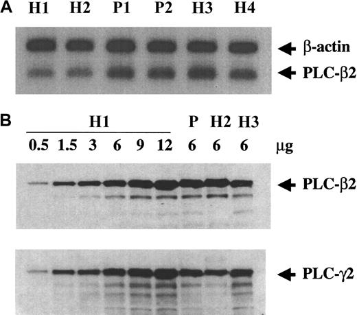 Fig. 7. Neutrophil PLC-β2 and PLC-γ2 levels. / (A) PLC-β2 mRNA levels in neutrophils. First-strand cDNA from neutrophils from the patient (P) and healthy subjects (H) was amplified by PCR using primers for PLC-β2 corresponding to 2864 nt to 2882 nt (forward) and 3328 nt to 3352 nt (reverse) along with primers for β-actin (758-bp fragment). The products were analyzed as described in the Figure 2 legend. P1 and P2 represent patient samples from 2 separate visits. Results shown are representative of 3 separate experiments. (B) Immunoblots showing PLC-β2 and PLC-γ2 levels in neutrophil lysates from patient (P) and 3 healthy subjects. The neutrophil lysates were subjected to electrophoresis and transferred to membrane. The PLC-β2 and PLC-γ2 were detected using specific antibodies and by chemiluminescence. Samples from healthy subject H1 were analyzed at increasing protein concentration from 0.5 μg to 12.0 μg subjected to gel electrophoresis. Samples from patient (P) and healthy subjects H2 and H3 were analyzed at 6 μg protein. Results shown are representative of 3 separate experiments.