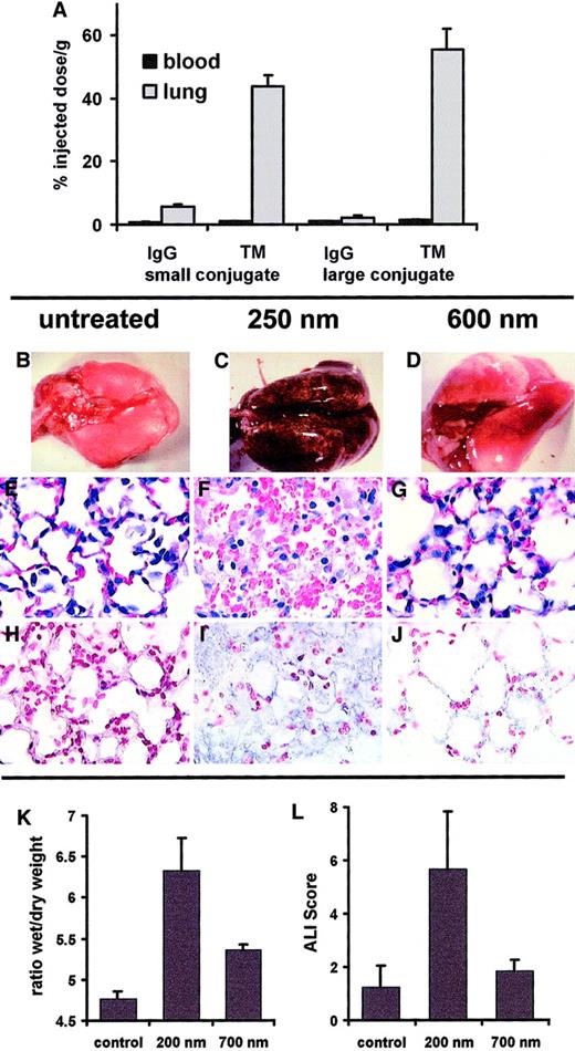 Fig. 8. Effect of size on pulmonary targeting and effects of GOX conjugates (anti-PECAM/GOX and anti-TM/GOX) in intact mice. / Blood level (black bars) and pulmonary uptake (gray bars) of small (250-nm, left part) versus large (600-nm, right part) anti-TM/125I-GOX or IgG/125I-GOX conjugates (2 to 3 μg per mouse) 1 hour after intravenous injection (panel A; accumulation data of anti-PECAM/125I-GOX in murine lung are not shown). Pathological changes in the lungs harvested 3 hours after IV injection of 50 μg per mouse of small (C,F,I) or large (D,G,J) anti-TM/GOX conjugate versus saline injection (B,E,H). Panels B, C, and D show lung gross pathology; note severe hemorrhagic lung injury in panel C. Panels E, F, and G show hematoxylin/eosin staining of lung tissue sections; note edema and vascular injury in panel F. Panels H, I, and J show immunostaining for the products of lipid peroxidation; note positive reaction (blue color) in panel I. Original magnifications, panels E-J, × 40. Tissue edema determined as lung wet-to-dry ratio (K) and ALIS (L) in the lungs harvested 3 hours after IV injection of 50 μg per mouse of small (200-nm) or large (700-nm) anti-PECAM/GOX conjugate versus saline injection (control).