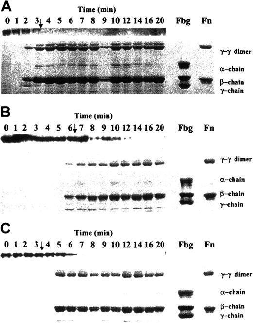 Fig. 6. Depletion of fibrinogen and solid clot formation during TF-initiated clotting of whole blood. / Samples for fibrinogen and solid-clot analyses were obtained from experiments shown in Figure 5. Upper lanes in each panel represent soluble fibrinogen; lower parts represent solubilized solid clots. Panel A shows normal blood without factor VIIa addition; panel B, congenital hemophilia A blood without factor VIIa addition; and panel, C congenital hemophilia A blood with 10 nM factor VIIa addition. Arrows indicate clotting times. Fbg indicates fibrinogen; Fn, fibrin.