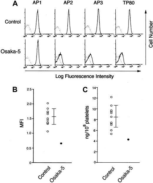Fig. 1. Flow cytometric analysis and quantitative ELISA for platelet β3 integrins on control and Osaka-5 platelets. / (A) Expression of αIIbβ3. Washed platelets obtained from a control subject and patient Osaka-5 were incubated with 10 μg/mL AP1 (specific for GPIb), 10 μg/mL AP2 (specific for αIIbβ3 complex), 10 μg/mL AP3 (specific for β3), or 10 μg/mL TP80 (specific for αIIb) for 30 minutes at 22°C. After washing, bound MoAbs were detected by FITC-conjugated goat F(ab′)2 antimouse IgG. MOPC21 (mouse IgG1) was used as a negative control (dotted line). (B) Expression of αvβ3. Control and Osaka-5 platelets were incubated with 5 μg/mL LM609 (specific for αvβ3 complex) for 30 minutes at 22°C. After washing, bound MoAbs were detected by Alexa-conjugated goat F(ab′)2 antimouse IgG. MOPC21 (mouse IgG1) was used as a negative control (dotted line). The amounts of bound LM609 were expressed as MFI from 11 control subjects (mean ± SD) and MFI from patient Osaka-5 (mean of duplicate). (C) The amounts of αvβ3 measured by quantitative ELISA; 100 μL platelet lysate (1 × 106 platelets/μL) was applied to a sandwich ELISA. Standard curve was obtained using purified αvβ3. Data represents the mean ± SD from 11 control subjects.