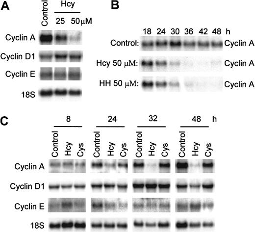 Fig. 2. Suppression of cyclin A, but not cyclin D1 and cyclin E mRNA expression by Hcy. / HUVECs were exposed to 25 μM or 50 μM dl-Hcy for 30 hours (A), to 50 μM dl-Hcy or l-HH (B), and to 50 μM dl-Hcy or l-Cys (C) for the indicated times. Total cellular RNA (10 μg) was used for Northern blot analysis. The RNA blot was hybridized to human cyclin A, D1, and E probes successively, and then to an 18S oligonucleotide probe (n = 3).