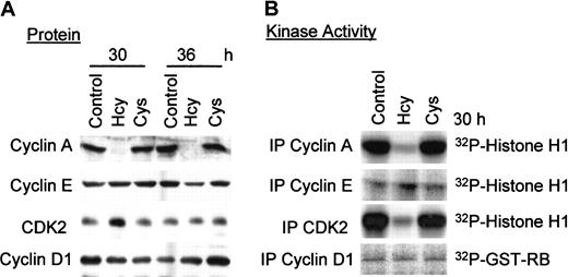 Fig. 3. Effect of Hcy on the protein expression and kinase activity of G1/S cyclins and CDK2. / HUVECs were exposed to 50 μg dl-Hcy or l-Cys for the indicated times. Proteins (50 μg) were analyzed by Western blotting with antibodies against cyclins A, D1, E, or CDK2 respectively (A), and by immunoprecipitation with the same antibody for associated kinase or kinase activity (B). Histone H1 (200 μg/mL) was used as phosphorylation substrate for cyclin A, E, or CDK2. GST-RB (40 μg/mL) was used as phosphorylation substrate for cyclin D1.
