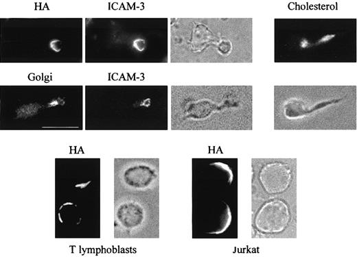 Fig. 1. HA is selectively transported to the uropod in polarized T lymphoblasts. / Human T lymphoblasts or Jurkat cells were infected with influenza virus for 4 hours at 37°C. Unpermeabilized T lymphoblasts were fixed and subjected to double labeling with mouse anti-HA mAb and rabbit anti–ICAM-3 antibodies. After permeabilization with 0.2% Triton X-100, T-cell blasts were analyzed with filipin to stain the cellular cholesterol, or double-labeled with anti-Golgi 58K and anti–ICAM-3 antibodies. Spherical blasts and Jurkat cells (bottom panels) were labeled with anti-HA antibodies in the absence of permeabilization step. To show cell morphology bright field images are depicted. Bar is 10 μm.