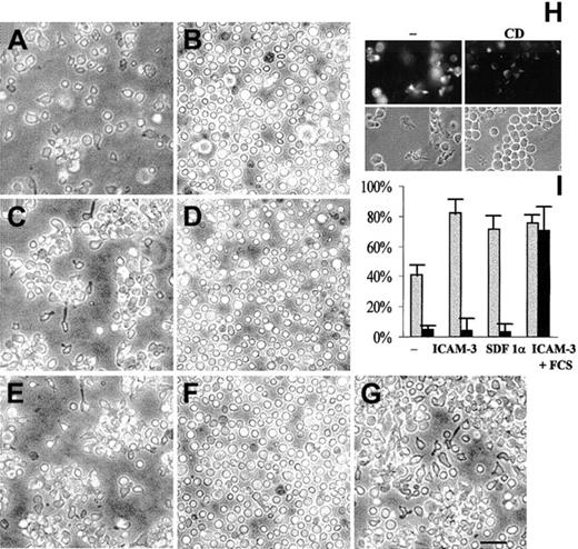 Fig. 3. Cholesterol sequestration prevents the induction of uropod structures in T lymphoblasts. / Control (A,B) or T lymphoblasts stimulated with 100 ng/mL SDF-α (C,D) or 1 μg/mL anti–ICAM-3 HP2/19 mAb (E-G) were treated (B,D,F,G) or not (A,C,E) with 8 mM CD in RPMI medium. After CD treatment, part of the cell culture stimulated with anti–ICAM-3 HP2/19 mAb was washed and incubated in RPMI medium supplemented with 20% FCS in the absence of CD (G). Bar is 20 μm. Panel H shows the cholesterol levels, as detected by staining with filipin, in control (−) or in T lymphoblasts treated with CD. Bright field images are depicted to show the cell field. The presence of uropod in approximately 500 cells was analyzed in 3 independent replicates. The results obtained in untreated (gray bars) and CD-treated (black bars) cells are represented as percentage of uropod-bearing cells present in the culture (I). The mean ± SD is shown.