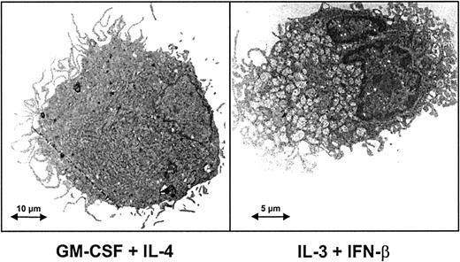 Fig. 3. Ultrastructure of cells derived from monocytes cultured in the presence of IFN-β and IL-3. / Transmission electron microscopy of monocytes after culture for 6 days with either GM-CSF and IL-4 or IL-3 and IFN-β. IL-3–IFN-β DCs and GM-CSF–IL-4 DCs showed the typical appearance of dendritic cells, including a lobulated nucleus, long cytoplasmic processes, and tubulovesicular system. In the presence of IL-3 and IFN-β DCs appeared as smaller cells filled with mitochondria.