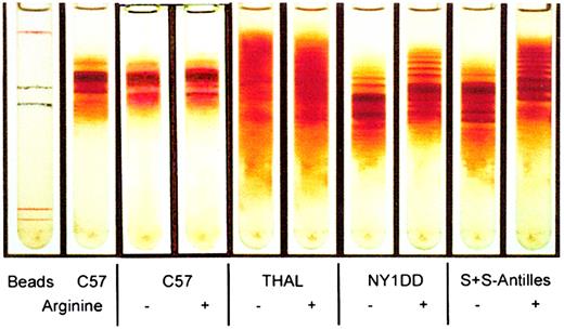 Fig. 2. Arginine supplementation causes a reduction of mean corpuscular hemoglobin concentration and dense cells in transgenic mice. / Percoll-Larex continuous density gradient of mouse red cells obtained from mice either not supplemented with arginine (−) or mice supplemented with 5% arginine (+) for a 10-week period.