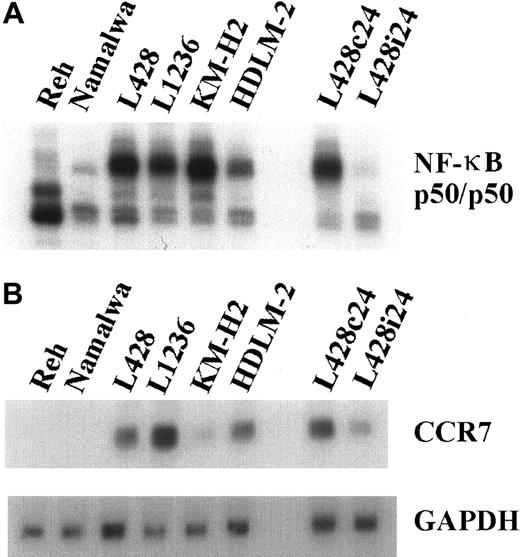 Fig. 4. CCR7 expression is NF-κB dependent. / (A) NF-κB binding activity. Whole-cell extracts of HD cell lines and control cells were analyzed by EMSA using H2K binding site probe for NF-κB. (B) RNA was extracted 24 hours after infection from L428 cells infected with Ad5-control (L428c24) or Ad5-IκBΔN (L428i24), and from different control and HD cell lines. Northern blot analysis was performed using an α32P-labeled CCR7 cDNA probe (upper panel). As a control, the stripped blot was reprobed with an α32P-labeled GAPDH cDNA probe (lower panel).