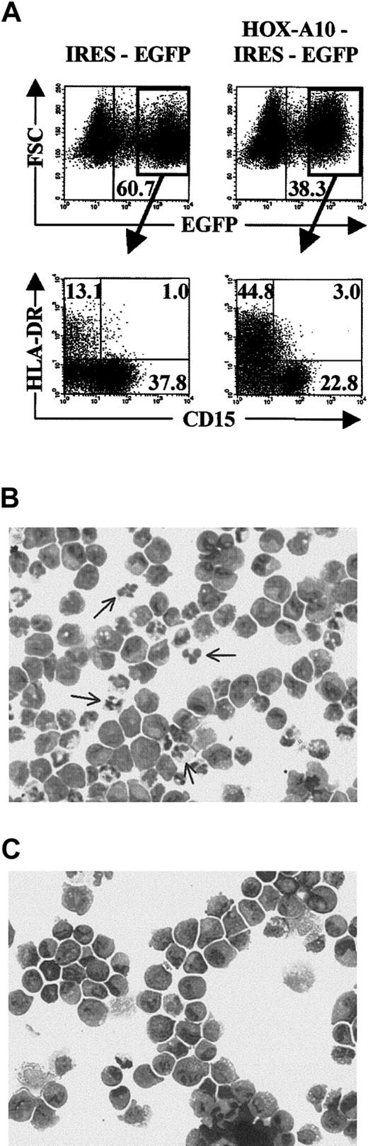 Fig. 5. Overexpression of. / HOX-A10 slightly reduces the generation of CD15+ granulocytic cells and blocks their final maturation. (A) Four-color flow cytometric analysis of cells recovered from MS-5 stromal cell cultures in the presence of SCF, FL, TPO, and G-CSF, initiated with IRES-EGFP– and HOX-A10-IRES-EGFP–transduced CD34+ Lin− CB cells. Dot plots show FSC compared with EGFP and HLA-DR-APC compared with CD15-PE for IRES-EGFP– and HOX-A10-IRES-EGFP–transduced CD34+ Lin− CB cells on day 14 of culture. Quadrants were set to include at least 99% of cells stained with isotype controls in the lower left quadrants. Values in the corresponding dot plots indicate the percentage of cells in the corresponding quadrant. (B) Wright-Giemsa staining of EGFP+CD15+ cells sorted from IRES-EGFP–transduced cell cultures shown in panel A. The arrow indicates mature granulocytes. (C) Wright-Giemsa staining of EGFP+ CD15+ cells sorted from HOX-A10-IRES-EGFP–transduced cell cultures shown in panel A. Original magnification B-C, × 200.