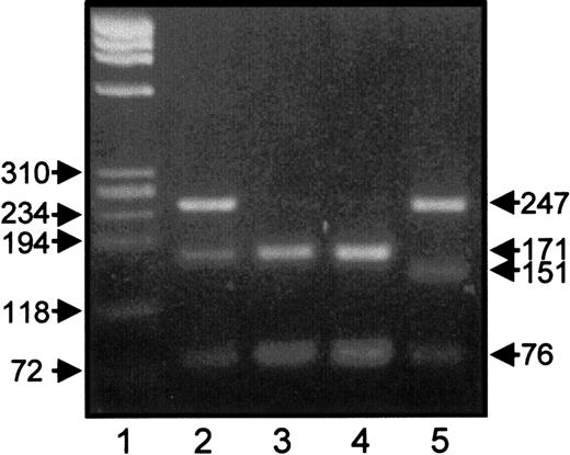 Fig. 2. RFLP analysis of HPA-1 genotypes. / PCR products of GPIIIa gene of heterozygous HPA-1a/1b, Oea (+) father (lane 2), homozygous HPA-1b/b, Oea (+) grandfather (lane 3), homozygous HPA-1b/1b control individual (lane 4), and heterozygous HPA-1a/1b having Arg40 mutation (lane 5) were digested withMspI endonuclease and were analyzed on 2.2% agarose gel stained with ethidium bromide. Lane 1 represents DNA size standard (pBR322 HaeIII DNA fragments).