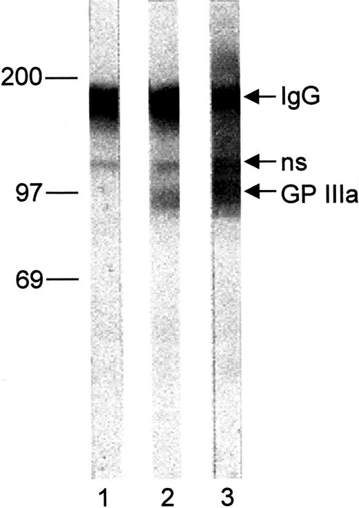 Fig. 3. Immunoblot of Oea (+) platelets. / Paternal platelet lysate was separated on 7.5% SDS-PAGE under nonreducing conditions and transferred onto nitrocellulose paper. After incubation with eluates from normal human serum (lane 1), anti-Oea (lane 2), and anti–HPA-1a (lane 3) bound IgG were detected with BCIP as substrate; ns indicates nonspecific binding.