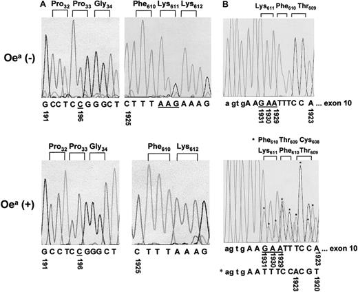 Fig. 5. Nucleotide sequence analyses. / (A) Nucleotide sequence analysis of amplified GPIIIa cDNA derived from an Oea (−) individual (HPA-1b/1b) and the Oea (+) (HPA-1b/1b) grandfather. PCR products encompassing bases 56-698 (left panel) and bases 1666-2415 (right panel) were subcloned into the plasmid vector pGEM-5Zf and sequenced. The missing of the triplet AAG (underlined) in Oea (+) individual results in ΔLys611. Both individuals carry the Pro33 GPIIIa form, which corresponds to their HPA-1b phenotypes. (B) Nucleotide sequence analysis of amplified GPIIIa DNA derived from Oea (+) and Oea (−) individuals. PCR products encompassing the entire exon 10 were sequenced directly. The mutated GPIIIa allele of Oea (+) individual is shown by the asterisks (top panel). The deletion of the triplet AAG (underlined) resulting in a shift of 3 bases was observed in Oea (+), but not in Oea (−) individual (bottom panel).