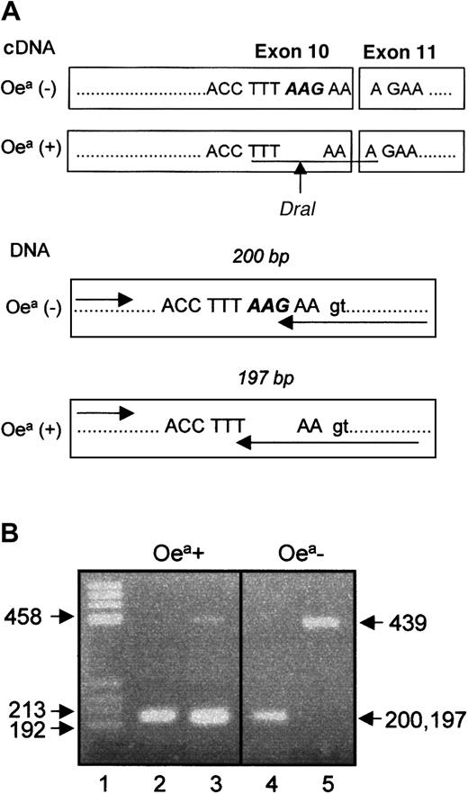 Fig. 6. Location of ΔLys611 in GPIIIa cDNA and genomic DNA. / (A) Location of the AAG deletion in exon 10. The arrow indicates the cleavage site of DraI endonuclease in cDNA from Oea (+) individual. The recognition site of the enzyme is underlined. (B) Genotyping analysis of Oea alloantigen by PCR-SSP. The genotyping of Oea-phenotyped individuals (father and grandfather) using wild-type primer (lanes 2 and 4) or mutant primer (lanes 3 and 5) is shown. The 439-bp fragment represents the internal control. Note that reverse primer (arrow) specific for mutant (T) and wild-type allele (G) amplified products with 3 bases different in length (200 bp versus 197 bp).