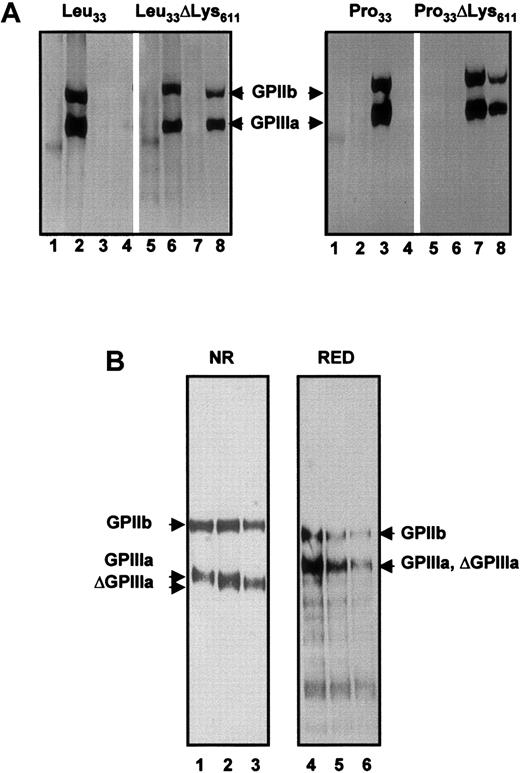 Fig. 7. Immunoprecipitation analysis of allele-specific recombinant GPIIIa isoforms. / (A) Recombinant isoforms of GPIIb-IIIa complex were produced in CHO cells transfected either with Leu33, Leu33ΔLys611, Pro33, or Pro33ΔLys611 constructs of GPIIIa. Biotinylated cell lysates were immunoprecipitated with AB serum (lanes 1 and 5), anti–HPA-1a (lanes 2 and 6), anti–HPA-1b (lanes 3 and 7), and anti-Oea alloantibodies (lanes 4 and 8). Immunoprecipitates were analyzed on 7.5% SDS-PAGE under nonreduced conditions. (B) Electrophoretic mobilities of Pro33 and Pro33 ΔLys611 GPIIIa isoforms. Biotin surface-labeled GPIIb-IIIa complex derived from CHO transfectants was immunoprecipitated with mAb Gi5 and analyzed on 7.5% SDS-PAGE under nonreduced (NR) and reduced (RED) conditions. Lanes 1 and 5, Pro33; lanes 2 and 4, a mixture of Pro33 and Pro33 ΔLys611; and lanes 3 and 6, Pro33 ΔLys611 GPIIIa isoforms.