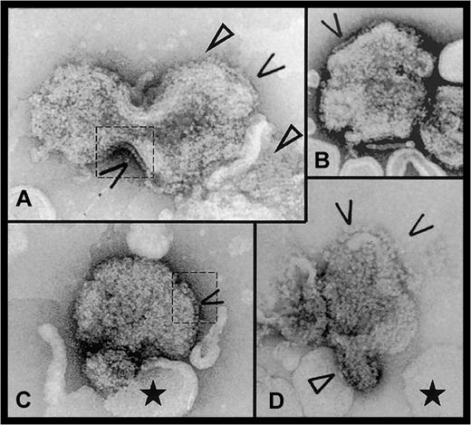 Fig. 1. Electron micrographs of FVIII bound to DOPS/DOPC liposomes. / Open arrows indicate side-on views of membrane-attached FVIII molecules. In panels A and C, dashed line areas where the protein molecules are clearly visible on the liposome edges are contoured. Closed arrows show 2D arrays of FVIII molecules. The black star indicates the ‘naked’ liposomes, without attached FVIII, showing the cooperative effect of FVIII binding. Scale bar is 100 nm.