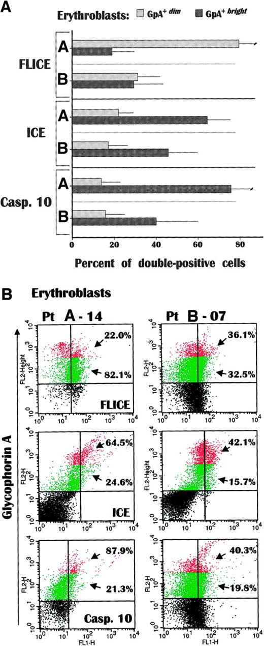 Fig. 4. Caspase expression in fresh GpA. / +dim and GpA+brighterythroblasts. FLICE was greatly accumulated in GpA+dim cells from group A, whereas both ICE and caspase-10 occurred at significantly higher values in their GpA+brighterythroblasts than in group B. Although the analysis evaluated the extent of proenzyme caspases, the differential accumulation of these proteases in fresh erythroid cells suggested the occurrence in vivo of separate apoptotic stimuli through Fas in immature erythroblasts, and TRAIL receptors as the maturation progresses. Data are expressed as mean ± SD of double-fluorescence analysis. (B) Flow cytometric pattern of caspase expression in GpA+dim (green) and GpA+bright (red) erythroblasts in a representative anemic (A-14) and a nonanemic (B-07) patient. The percentages indicate the number of positive cells within each erythroblast subset.