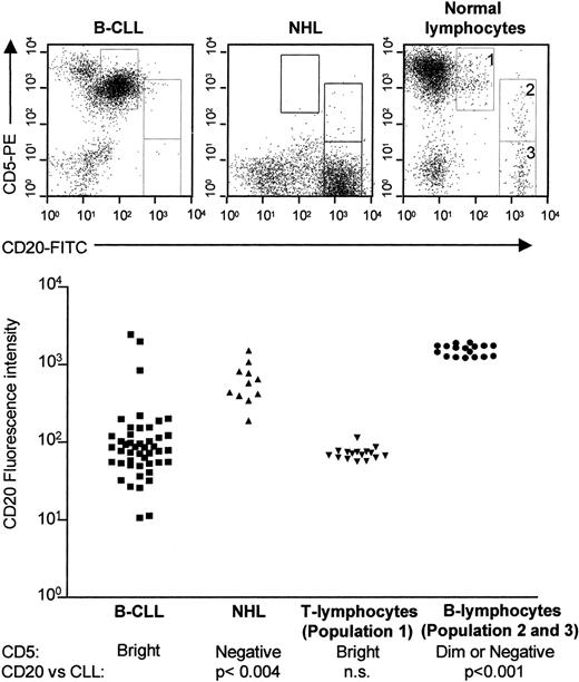 Fig. 1. CD5/CD20 expression on B-CLL cells, low-grade NHL cells, and normal lymphocytes. / Mononuclear cells were isolated from peripheral blood of B-CLL patients (n = 44); from blood, bone marrow, or fine-needle lymph node aspirates from patients with low-grade NHL (n = 11), and from buffy coats from healthy volunteer blood donors (n = 16). The mononuclear cells (1 × 106/mL) were stained simultaneously with FITC-conjugated anti-CD20 and phycoerythrin-conjugated anti-CD5 monoclonal antibodies, or isotype-matched control antibodies, and analyzed on a FACSort flow cytometer. Normal lymphocytes can be divided into 3 populations: (1) CD5brightCD20dim; (2) CD5dimCD20bright; and (3) CD5−CD20bright populations (top, right panel). In B-CLL samples, one population of CD5brightCD20dim cells can be identified (top, left panel). In NHL samples, one population of CD5−CD20bright cells can be identified (top, middle panel). The mean CD20 fluorescence intensity on B-CLL cells is significantly weaker than that of normal CD5dim or CD5− B cells or CD5− NHL cells, but not statistically different from that of normal CD20dimCD5bright cells, which express CD3, CD4, or CD8, in the absence of B cells, natural-killer (NK) cells, and myeloid-lineage markers (bottom).