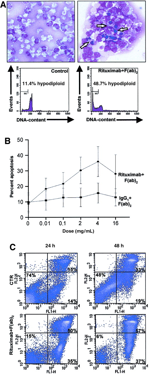 Fig. 2. Effect of rituximab on freshly isolated B-CLL cells. / (A) First, 2 × 106/mL freshly isolated B-CLL cells were cultured for 24 hours in the presence (right panel) or absence (left panel) of 4 μg/mL rituximab and 20 μg/mL mouse anti–human IgG1 F(ab)2 fragment. Cytospin slides were prepared from 2 × 105 cells and stained with May-Grünwald-Giemsa (top panels). Apoptotic cells are indicated by arrows. Original magnification × 100. For quantification of the degree of apoptosis, isolated nuclei from 5 × 105cells from the same experiment were lysed, stained with PI, and analyzed for DNA content on a FACSort flow cytometer. Several condensed and fragmented apoptotic nuclei appear in the cells cultured in the presence of rituximab (top, right panel); concomitantly, apoptotic nuclei appear within the hypodiploid region (M1) of the DNA histogram (bottom, right panel). (B) Freshly isolated B-CLL cells from 7 patients were cultured for 24 hours in triplicate with the indicated concentrations of rituximab and secondary antibody in 5-fold excess. Following harvest and washing, the cells were subsequently analyzed for DNA content as above. Dots and squares indicate the mean percentages of apoptotic cells at the indicated concentrations; error bars indicate the estimated 95% confidence intervals of the means. (C) Freshly isolated B-CLL cells were cultured as described in panel A, for 24 or 48 hours. After harvest, cells were incubated with FITC-conjugated annexin V and counterstained with PI in order to detect early apoptotic and late apoptotic/necrotic cells by flow cytometry. The lower left quadrants of each panel show the viable cells, which exclude PI and are negative for annexin V–FITC binding. The lower right quadrants represent the early apoptotic cells, annexin V–FITC+ and PI−, demonstrating cytoplasmic membrane integrity. The upper right quadrants contain the nonviable, late apoptotic/necrotic cells, positive for annexin V–FITC binding and for PI uptake.