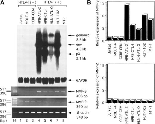 Fig. 1. Northern blot analysis of HTLV-I mRNA expression and RT-PCR analysis of MMP-2 and MMP-9 mRNA levels in various HTLV-I–infected and uninfected human T-cell lines. / (A) Total RNA was prepared from the indicated T-cell lines. Predominant HTLV-I mRNA species of 2.1, 4.2, and 8.5 kb were detected in HPB-ATL-2, HPB-CTL-I, HLN-ATL-O, and HUT-102 cell lines (lanes 4-7). GAPDH and β-actin expression served as controls. (B) Quantitative hybridization capture assay to detect amplified nucleic acid of MMPs. Expression levels of MMP mRNA were calculated from the ratios of the amount of amplification product of MMPs to that of β-actin. Results show relative levels of the MMPs/β-actin in each line compared with that in HTLV-I–negative Jurkat cells.