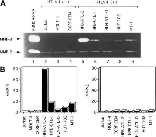 Fig. 2. Zymographic analysis of conditioned media from various T-cell lines. / (A) A total of 12 μL conditioned medium was subjected to electrophoresis on 10% SDS-polyacrylamide gels containing 1 mg/mL gelatin. SDS was removed following electrophoresis, and gels were incubated to restore gelatinase activity. Lane 1, conditioned media from PBMCs activated by PMA (positive control for MMP-2 and MMP-9). Major gelatinolytic activities corresponding to pro–MMP-9 (92 kd) and pro–MMP-2 (68 kd) are indicated. (B) Densitometric scan of MMP bands in (A) shows relative levels of the amounts of MMPs in each line compared with those in HTLV-I–negative control MOLT-4 cells.
