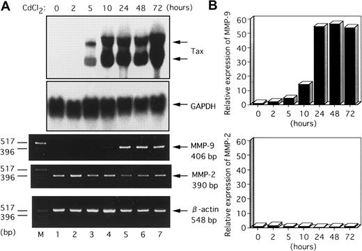 Fig. 3. Induction kinetics of the MMP-9 gene in JPX-9 cells treated with CdCl2. / (A) Total RNA samples were prepared from CdCl2-treated JPX-9 cells at the indicated time points (0-72 hours). The expression of Tax and MMPs in the extracted RNA was analyzed by Northern blot and RT-PCR analysis, respectively. GAPDH served as a loading control for Northern analysis, whereas β-actin served as an internal control in the RT-PCR procedure. (B) Quantitative hybridization capture assay to detect amplified nucleic acid of MMPs. Results are shown quantitatively as fold increase over the amount at time zero.
