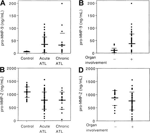 Fig. 10. Amounts of pro–MMP-2 and pro–MMP-9 in the plasma from patients with ATL. / Plasma pro–MMP-9 (A) and pro–MMP-2 levels (C) in 24 healthy volunteers, in 51 patients with acute ATL, and in 20 patients with chronic ATL. Plasma pro–MMP-9 (B) and pro–MMP-2 levels (D) in 14 ATL patients without organ involvement (−) and in 45 ATL patients with organ involvement (+). The bars indicate the mean value ± SD of each group.