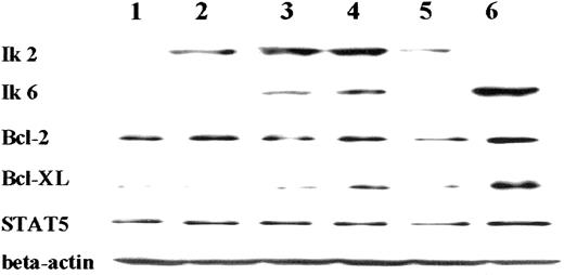 Fig. 4. Western blot analysis of Ik2, Ik6, Bcl-2, Bcl-XL, and STAT5 expression in a Cos-7/pRC/CMV/Ik2/TREx/Ik6 clone. / Expression was tested before (lane 2) and at 12 hours (lane 3), 16 hours (lane 4), and 24 hours (lane 5) after Ik6 induction. Lane 1 (Cos-7/TREx/empty) served as the negative control for Ik2 and 6, whereas lane 6 (Cos-7/pRC/CMV/Ik6) was the positive control for Ik6. Bcl-XL was up-regulated after induction of Ik6 (lanes 3, 4, and 5).
