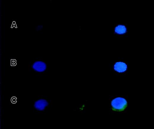 Fig. 7. Subcellular localization of Ik2 and Ik6 proteins. / Ik2 was localized in the chromatin structure of 32D cells expressing wild-type Ikaros proteins (A) and overexpressed IK2 (B), whereas both Ik2 and Ik6 were localized in the cytoplasm of 32D cells expressing Ik6 alone.