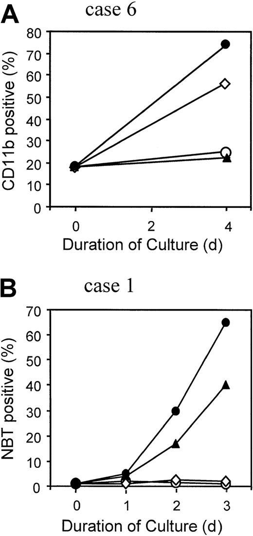 Fig. 6. Differentiation response of APL cells. / APL cells from case 6 (A) and from AP-1060 cells derived from case 1 (B) were cultured for the indicated time in the absence of agents (○), in 1 μM RA (▴), in 1 mM NaB (⋄), or in 1 μM RA + 1 mM NaB (●). The percentage of terminally differentiated APL cells was measured in case 6 by the expression of CD11b surface antigen detected by flow cytometry (A) or in AP-1060 cells by the nitroblue tetrazolium dye reduction test (B).