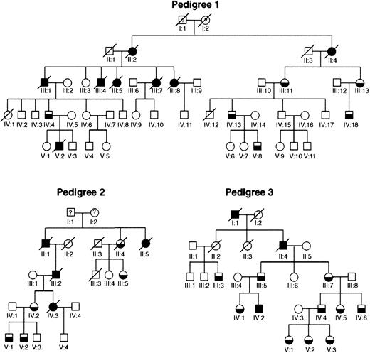 Fig. 1. The FPD/AML pedigrees unique to this study. / All 3 pedigrees show linkage to FPD/AML locus (21q22.1-22.2). Half-filled symbols represent individuals who had a bleeding disorder and, where studied, a platelet defect as well, and completely filled symbols represent affected individuals who developed leukemia.
