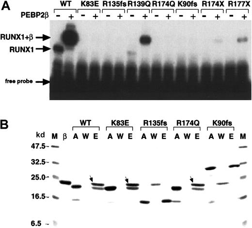 Fig. 3. Alterations in the DNA binding and heterodimerization activities of the Runt domain of FPD/AML RUNX1 mutations. / (A) Partial RUNX1 proteins (as indicated) were subjected to EMSA in the presence (+) and absence (−) of PEBP2β/CBFβ. WT indicates wild-type RUNX1. The position of the RUNX1 and RUNX1/CBFβ complexes with the DNA are indicated. (B) Affinity assay of the indicated partial RUNX1 proteins with PEBP2β/CBFβ. M indicates molecular weight marker as indicated both to the left and right; β, PEBP2β/CBFβ; A, input RUNX1 protein; W, unbound proteins in washed fractions; E, bound proteins eluted at 250 mM imidazole. The bands marked with arrows indicate the β subunits associated with RUNX1 proteins.