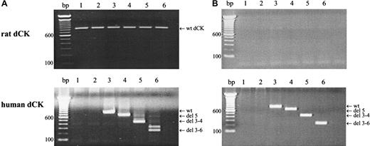 Fig. 1. Target gene expression in retrovirally transduced cells. / Target gene expression after retroviral transfection was analyzed by RT-PCR amplifications using rat-specific (upper panel) or human-specific (lower panel) dCK PCR-primers. (A) KA cells. (B) K7 cells. Lane 1, parental cells; lane 2, cells transduced with empty vector controls; lane 3, cells transduced with human wt dCK; lane 4, cells transduced with deletion exon 5 human dCK; lane 5, cells transduced with deletion exons 3 to 4 human dCK; lane 6, cells transduced with deletion exons 3 to 6 dCK. PCR fragments were separated on a 1.5% agarose gel and visualized by ethidium bromide staining.