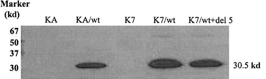 Fig. 2. Wild-type human dCK protein detection by Western blot analysis. / Proteins (30 μg) were separated by 12.5% SDS-PAGE and transferred to nitrocellulose membranes. Human dCK proteins were detected by staining with human dCK-pep mAb.