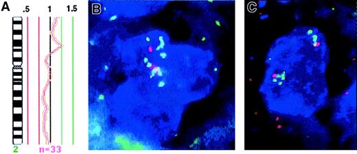 Fig. 3. Amplification of REL on chromosome 2p. / (A) Mean ratio profile of chromosome 2 in cHL-24 derived from 33 chromosomes analyzed by CGH (central line = ratio value 1; green lines = ratio values of 1.25 and 1.5; red lines = values of 0.75 and 0.5). The profile shows a distinct peak at chromosomal region 2p15-p16, which reaches the diagnostic threshold of 1.25 and indicates high-level DNA amplification. This region corresponds to the mapping position of the REL oncogene. (B, C) FISH analysis of cHL-24 with a REL specific probe (green) and a centromeric specific probe for chromosome 2 (red) on CD30+HRS cells (blue). Three to 4 centromeric signals are detected in each cell. Multiple green signals indicate amplification ofREL, therefore revealing this oncogene as part of the 2p15-p16 amplicon detected by CGH. Original magnification, ×630.