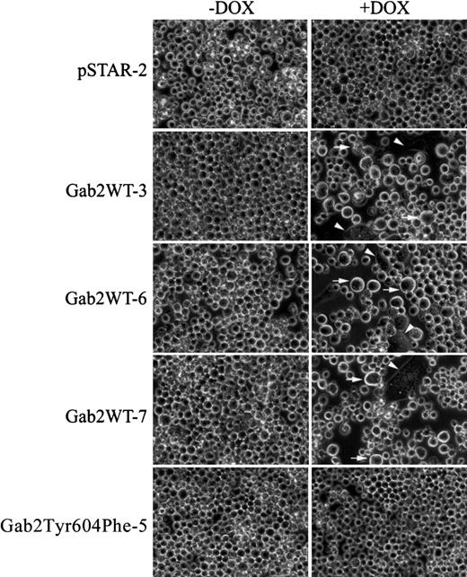 Fig. 6. Morphological changes in K562 cell lines induced to overexpress Gab2. / K562-derived cell lines pSTAR-2, Gab2WT-3, Gab2WT-6, Gab2WT-7, or Gab2Tyr604Phe-5 were plated (5 × 104 cells/mL) in 6-well plates and treated with or without dox for 6 days. Cell were digitally photographed at × 400 magnification with a Nikon TE300 microscope equipped with a CCD camera (Diagnostic Instruments, Sterling Heights, MI). Arrowhead indicates cells that are flattened and adherent to the plates; arrow, enlarged cells.