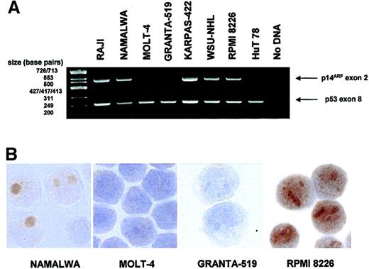 Fig. 1. p14ARF expression in lymphoid cell lines. / (A) Multiplex PCR demonstrating deletion of p14ARF exon 2 in some of the cell lines. p53 exon 8 is simultaneously amplified as a control. (B) Images showing absence of p14ARF staining in 2 cell lines with exon 2 deletion (MOLT-4, GRANTA-519) and nucleolar p14ARF expression in 2 nondeleted cell lines (NAMALWA, RPMI 8226). Note the nucleoplasmic staining for RPMI 8226 observed in addition to the nucleoli. Original magnification × 1000.