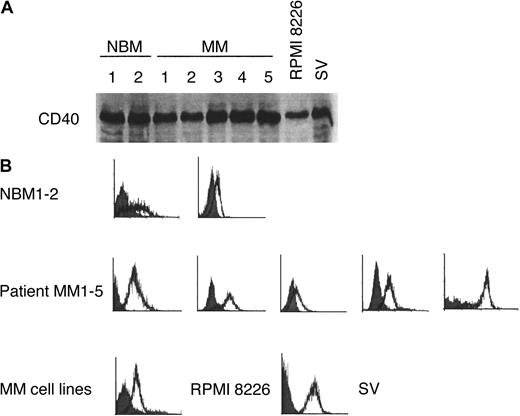 Fig. 1. CD40 expression in patient MM cells and cell lines. / CD40 expression on normal B cells (NBM1-2), patient MM cells (MM1-5), RPMI 8226, and SV MM cell lines was determined by (A) immunoblotting and (B) flow cytometry. Solid histogram, isotype control; open histogram, CD40.