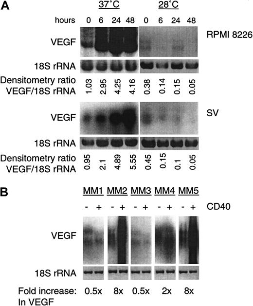 Fig. 3. CD40 activation induces VEGF transcripts in human MM cells expressing mutant p53. / (A) CD40-activated RPMI 8226 (upper panel) and SV (lower panel) MM lines were cultured for indicated intervals (0-48 hours), and total RNA (5 μg) was subjected to Northern blotting using human VEGF cDNA, as described in Figure 1. After probing for VEGF mRNA, the blot was stripped and hybridized with an 18S rRNA probe. The fold induction relative to 18S rRNA as a control was calculated by densitometry. Both cell lines express mt p53 at 37°C (restrictive temperature) and wt p53 at 28°C (permissive temperature). (B) Total RNA (5 μg) from patient MM cells without (−) or with (+) CD40 activation (24 hours) at 37°C was subjected to Northern blotting for VEGF expression. Fold induction of VEGF relative to an 18S rRNA probe was calculated by densitometry.