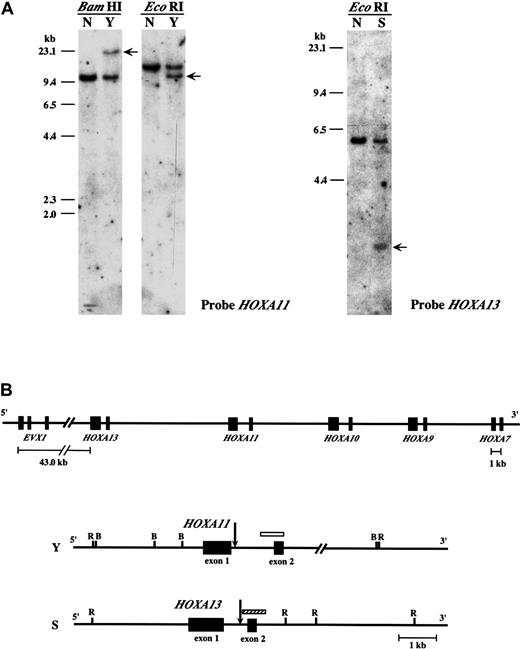 Fig. 2. Breakpoints of the. / HOXA11 and HOXA13 genes.(A) Southern blot analysis of leukemic cell samples derived from 2 patients with the t(7;11)(p15;p15) translocation (Y and S). (Left panel) Rearrangement of HOXA11 (arrows) was detected byBamHI and EcoRI digestion in patient Y. (right panel) Rearrangement of HOXA13 (arrow) was detected byEcoRI digestion in patient S. (B) Chromosome breaks on 7p15 in patient Y and S. (Top panel) Overview of the 5′ half of theHOXA cluster on chromosome 7. (bottom panel) Mapping of the breakpoints (arrows) within HOXA11 and HOX13 in patients Y and S, respectively. Locations of the probes used for Southern blot analysis are also shown as open (HOXA11) and hatched (HOXA13) boxes. R indicates EcoRI; B,BamHI.