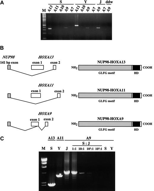 Fig. 3. Simultaneous detection of the. / NUP98-HOXA9 and NUP98-HOXA13 orNUP98-HOXA11 transcripts in patients S and Y. (A) The 378-bp NUP98-HOXA9 products were detected in patients S, Y, and J, the patient with t(7;11) AML with a HOXA9break. However, NUP98-HOXA7 and NUP98-HOXA10chimeras were not detected. In addition, the NUP98-HOXA11chimera was not observed in patient S. ddw indicates water control. (B) Structures of fusion transcripts and predicted proteins ofNUP98-HOXA13, NUP98-HOXA11, andNUP98-HOXA9 of the current patients with leukemia. (C) LD-PCR showed NUP98-HOXA fusion genes. Reverse primers for each HOX gene were indicated at the top, and the sample identity was indicated at the middle. Serial dilutions of J sample by patient S were also subjected to long-distance-PCR to check the detection limit of the NUP98-HOXA9 fusion. M indicates λ/HindIII DNA size marker.
