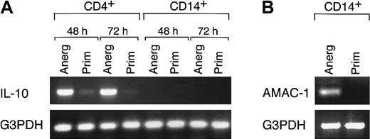 Fig. 3. IL-10 is produced by CD4+ cells isolated from anergizing MLR cultures. / (A) After the indicated time intervals of rechallenge in secondary MLR cultures, CD4+ and CD14+ cells were isolated by positive selection and examined for expression of IL-10 mRNA by RT-PCR. “Anerg” and “Prim” denote the culture conditions of primary MLR cultures. Results are representative of 4 experiments. (B) CD14+ cells isolated from 48 hours of secondary MLR as described in (A) were examined for expression of AMAC-1 by RT-PCR. Results are representative of 4 experiments.