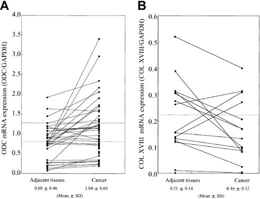 Fig. 1. mRNA expression levels of ODC and type XVIII collagen. / Total RNA was extracted from breast cancer tissues and the noncancerous adjacent tissue. (A) RT-PCR was performed by using primers specific for ODC. Band intensities were quantitated by using National Institutes of Health image software and normalized to the intensity of the GAPDH signal. Straight and broken lines indicate normal mean and mean + SD levels, respectively. (B) ODC overexpressing breast cancer tissue (15 pairs) was analyzed for type XVIII collagen mRNA expression. Band intensities were quantitated by using National Institutes of Health image software and normalized to the intensity of the GAPDH signal. The line indicates the normal mean level.