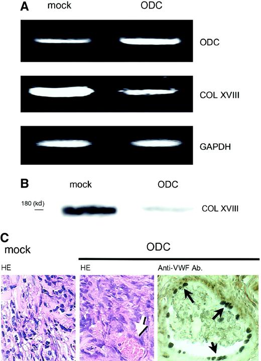 Fig. 3. In vivo effects of ODC overexpression on type XVIII collagen expression and neovascularization. / ODC-overexpressing transfectants and mock transfectants within a matrigel were injected subcutaneously into nude mice. Both transfectants formed tumors. (A) Total RNA was extracted from the transplanted cells; mRNA expression was then analyzed by RT-PCR. (B) Transplanted cells were homogenized and protein was extracted. Type XVIII collagen (COL XVIII) expression was analyzed by Western blotting by using a specific antiendostatin antibody. (C) Tumors were removed, fixed in formalin, and embedded in paraffin. Sections were then stained by using the hematoxylin-eosin and immunohistochemistry methods. Left and center panels show mock transplants and ODC transplants stained with the hematoxylin-eosin method, respectively. Right panel shows the endothelial cells in ODC transplants stained with anti-VWF antibody. Arrows indicate vessel in the tumor tissue. Original magnification for both HE, × 200; anti-VWF, × 400.