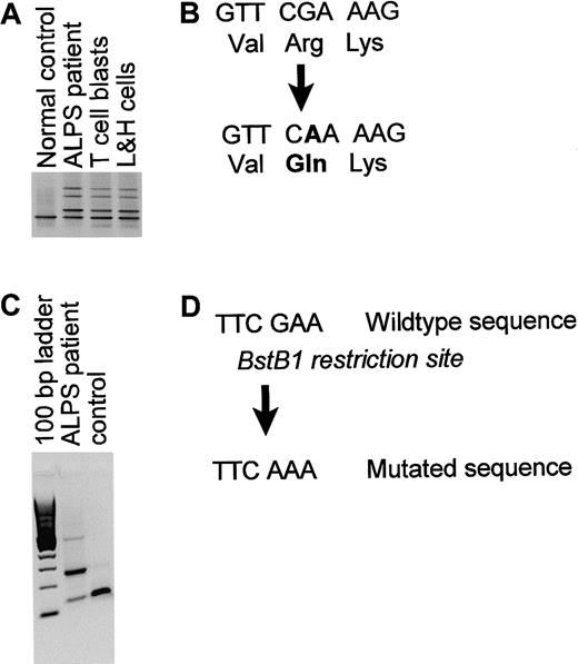 Fig. 2. FAS mutation analysis. / (A) Image of the DGGE analysis, including a control sample, total tissue section of the ALPS patient, micromanipulated T-cell blasts (approximately 100 cells, nested PCR) and L&H cells (10 cells, nested PCR). (B) Sequence of the aberrant homoduplex band obtained after direct sequencing. (C) Confirmation of the mutation using aBstB1 restriction enzyme digest.BstB1 cuts the normal PCR product of 257 base pairs (bp) at nucleotide 130-136 resulting in 2 fragments of approximately 130 bp. Only part of the PCR product of the ALPS patient is digested with the BstB1 restriction enzyme indicating that theBstB1 restriction site is disrupted in one allele of the FAS gene of the ALPS patient. (D)BstB1 restriction site in the wild-type sequence and the disrupted BstB1 restriction site in the mutated sequence.