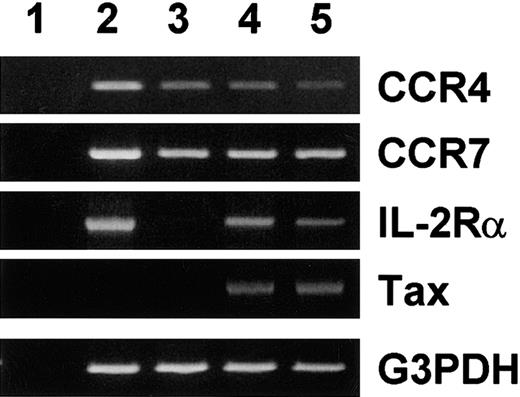 Fig. 1. Effect of tax on expression of CCR4 and CCR7 mRNA. / Total RNA was prepared from PBMCs stimulated with phytohemaggutinin (PHA) for 3 days and JPX-9 treated without (control) or with 10 μM of Cd2+ for 3 and 7 days. RT-PCR was carried out for CCR4, CCR7, IL-2 receptor α chain (IL-2Rα), Tax, and G3PDH as described in “Materials and methods.” (1) No RNA. (2) PHA-stimulated PBMCs (positive control). (3) Untreated JPX-9. (4) JPX-9 treated with Cd2+ for 3 days. (5) JPX-9 treated with Cd2+ for 7 days.