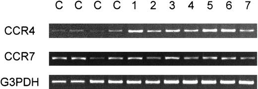 Fig. 2. RT-PCR analysis of PBMCs for expression of CCR4. / Total RNA was prepared from PBMCs obtained from 4 healthy adult donors (C) and 7 patients with ATL (1-7). RT-PCR was carried out for CCR4, CCR7, and G3PDH as described in “Materials and methods.”