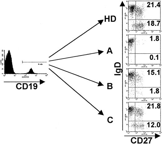 Fig. 1. Phenotypes of peripheral B cells of CVID patients. / PBMCs were stained for the expression of CD19, CD27, IgM, and IgD and analyzed by FACS. Analysis was performed by gating on CD19+cells, and dead cells were excluded by forward/side scatter gating. Representative examples of each CVID subgroup (A-C) according to the classification by Bryant et al9 as well as one healthy control (HD) are given. Indicated values represent percentages of gated CD19+ B cells. See “Patients, materials, and methods.”