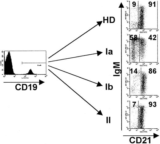 Fig. 4. Increase of CD21− B cells in CVID patients of group Ia. / PBMCs were stained for the expression of CD19, CD21, IgM, and IgD and analyzed by FACS. Analysis was performed by gating on CD19+B cells, and dead cells were excluded by forward/side scatter gating. Representative FACS dot blots of the new CVID subgroups Ia, Ib, II, and one healthy control (HD) are shown. Indicated values represent percentages of gated CD19+ B cells. See “Patients, materials, and methods.”